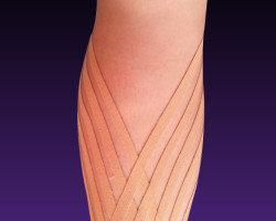 Kinesiotaping 4 31