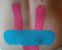 Kinesiotaping 7 6