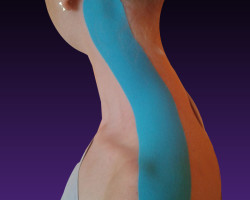 Kinesiotaping 8 71